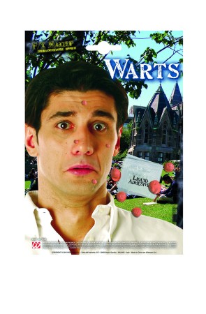 Set de 5 verrugas