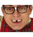 Dientes Mellados con Thermoplastica