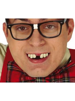 Dientes Mellados con Thermoplastica