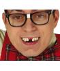 Dientes Mellados con Thermoplastica